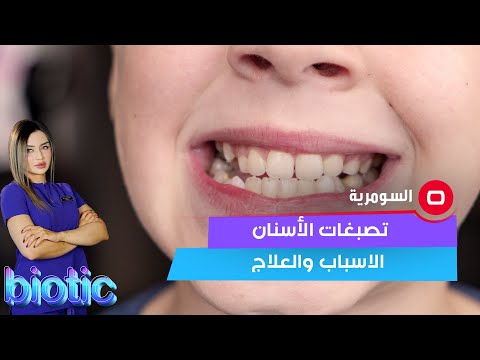شاهد بالفيديو.. تصبغات الأسنان الاسباب والعلاج