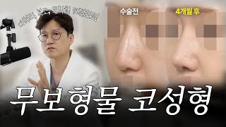 매부리코, 복코, 코막힘 개선! 자연스러운 무보형물 코성형 4개월 경과 케이스리뷰(기능코성형 = 비중격만곡증, 비갑개비대증 개선)