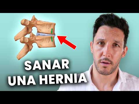 Hernia Discal: Cómo Sanar en 6 Etapas