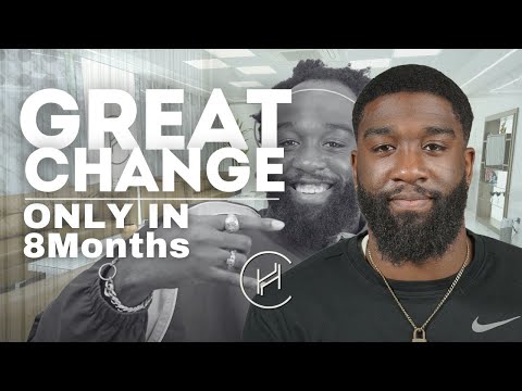 Afro Hair Transplant Success Story - 7 Months Transformation | 4500 Grafts | Heva Clinic