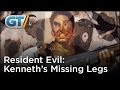 Pop Facts Resident Evil Kenneth S Missing Legs