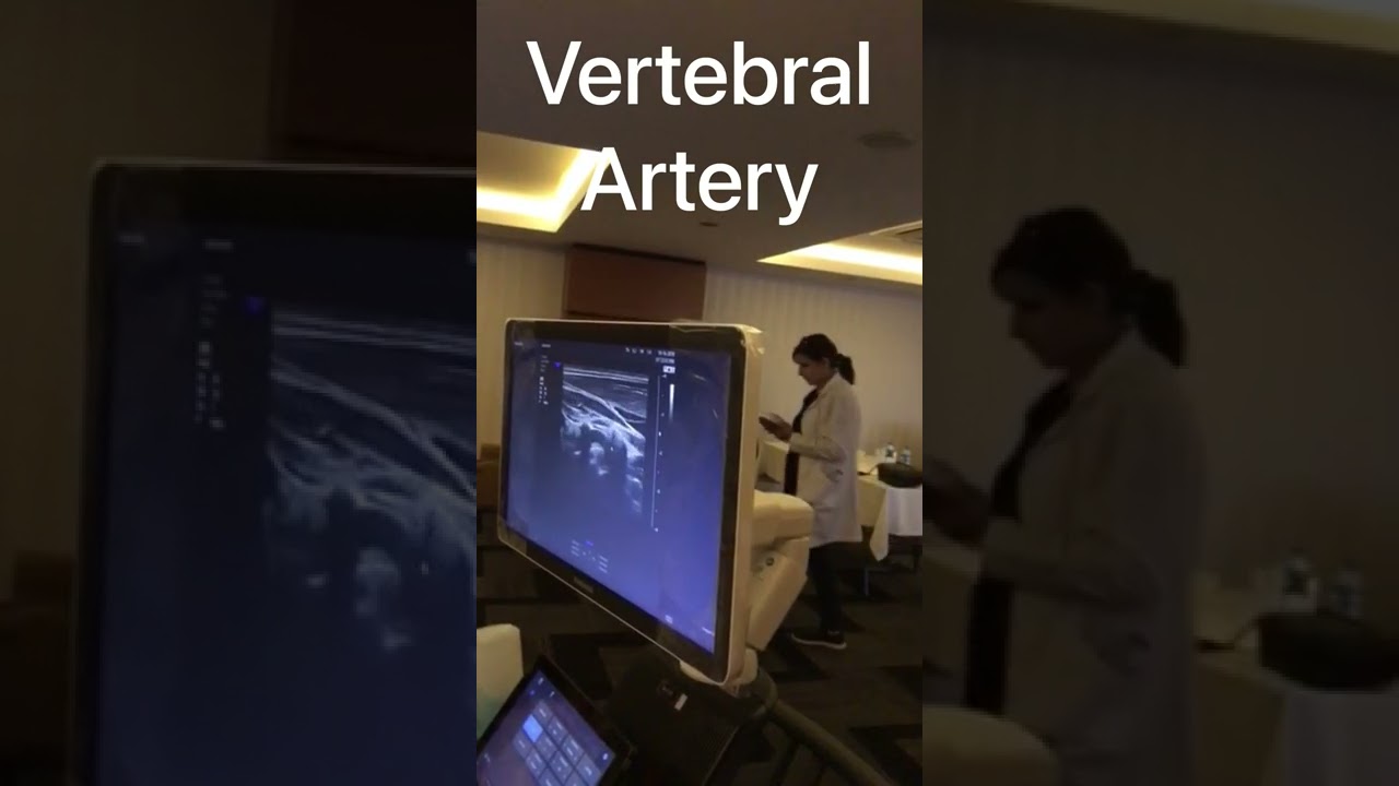 Trials to pick Vertebral Artery by Doppler -Arabic Version