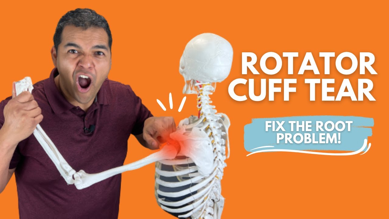 Rotator Cuff Tear Everything You Need To Know To Understand & Fix The Root Problem