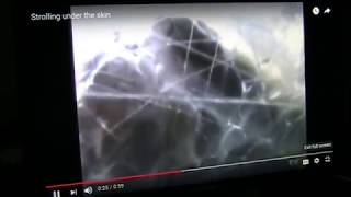 Infra Red and skin damage new research