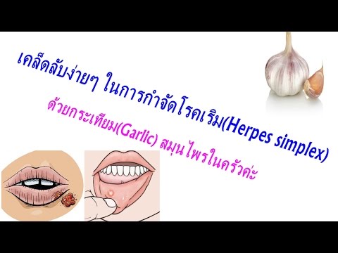 ตาไม้เรียวจากโรคสะเก็ดเงิน โรคสะเก็ดเงินก่อนและหลังภาพถ่ายอาหารดิบ