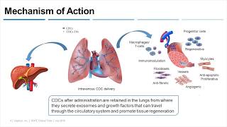 HOPE-2 Duchenne Clinical Trial – Capricor (July 2018)