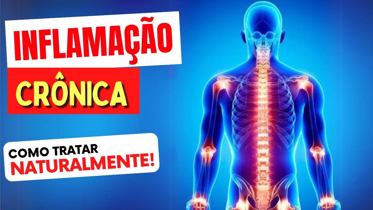 INFLAMAÇÃO CRÔNICA - O QUE É e Como TRATAR NATURALMENTE