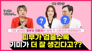 기미에 관한 궁금증 해결! OX 팩트 체크