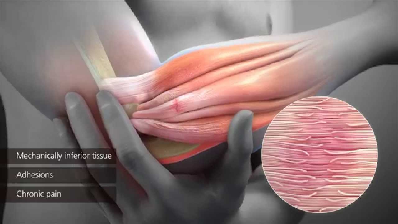 SAM Mechanisms of Action