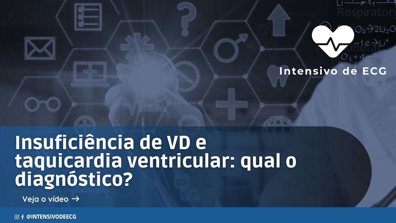 Insuficiência de ventrículo direito e taquicardia ventricular: qual o diagnóstico?