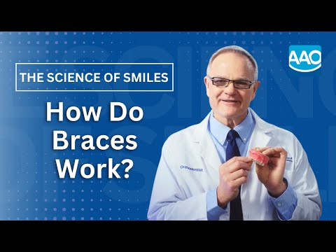 How Do Braces Work?
