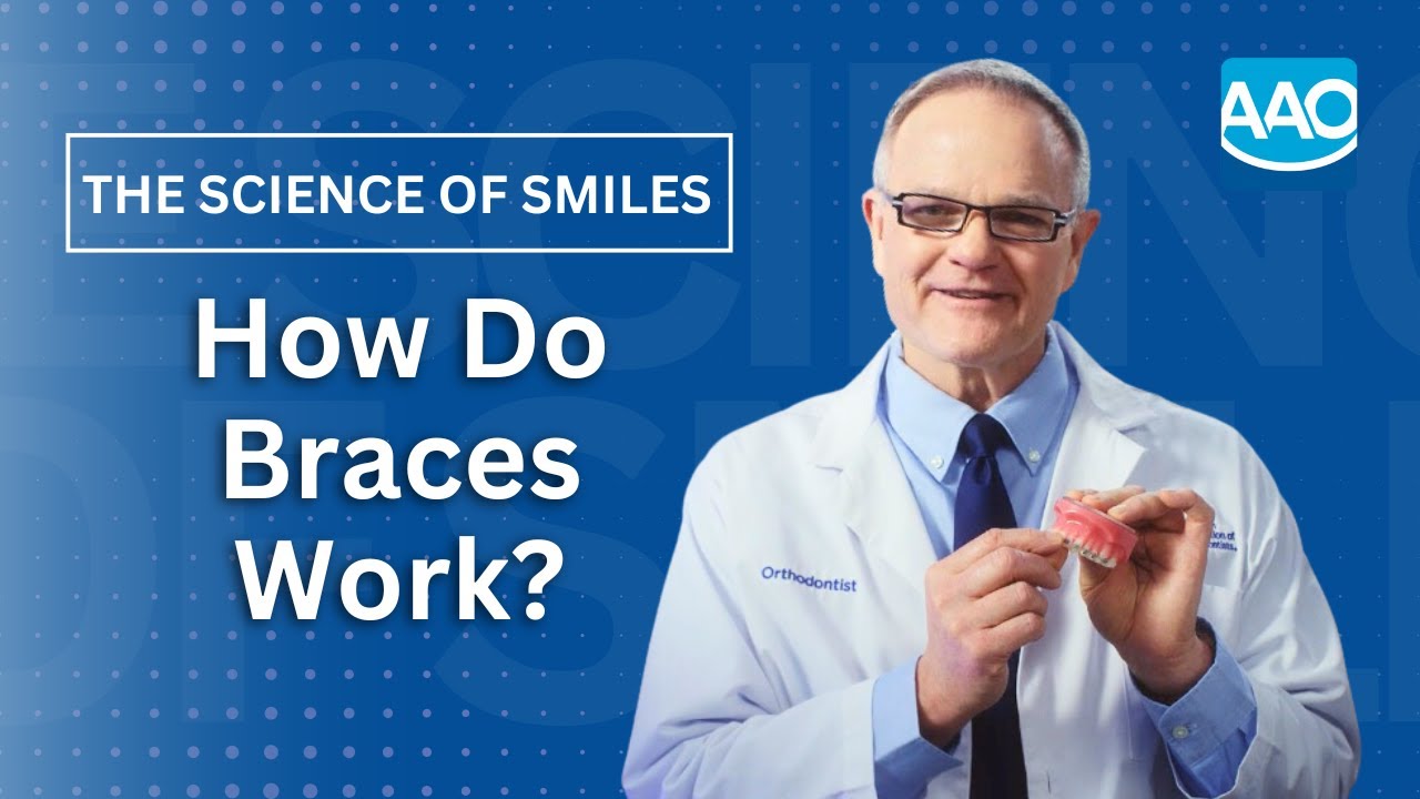 How Do Braces Work?