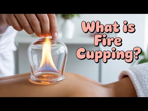 TCM Fire Cupping: Mastering the Art of Slide Cupping