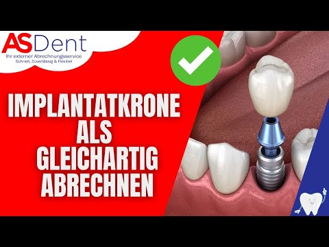 Implantatkrone als gleichartig abrechnen | ASDent - zahnmedizinische Abrechnung extern