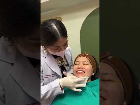 รีวิวหัตถการโปรแกรมฟิลเลอร์คาง