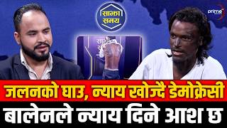 जलनपीडित डेमोक्रेसीको पिडा : जिन्दगी तहसनहस भयो, न्याय पाएन, बालेन शाहलाई भेट्न चाहन्छु !