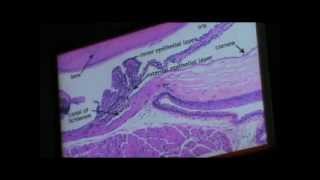 Dr Gehan Datashow Eye 30-4-2014