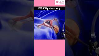 Download lagu Why hysteroscopy is done in IVF animation | IVF animation #ivf mp3