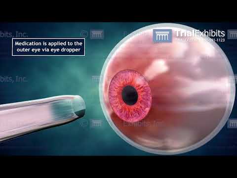 Seeing is Believing - Making Eye Anatomy Understandable