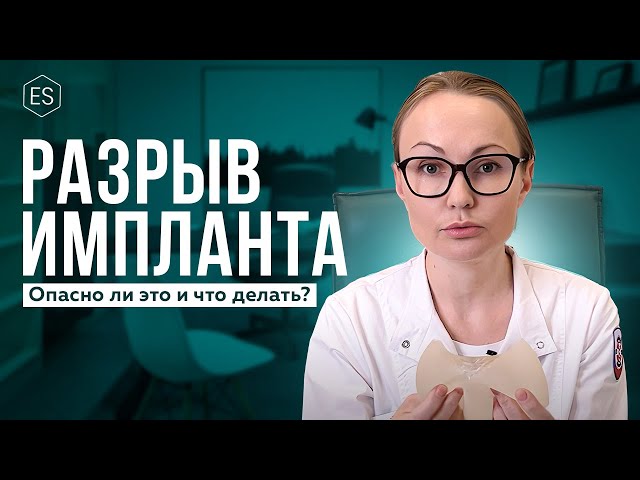 РАЗРЫВ ГРУДНОГО ИМПЛАНТА. Опасно ли это и что делать, если случилось?