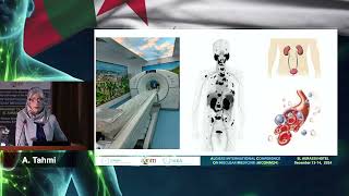 AICONM24 - Thérapie au 177Lu-PSMA dans le cancer de la prostate métastatique résistant (D.TAHMI)