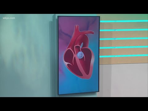 Throw down Thursday: Jay and Betsy test their heart knowledge