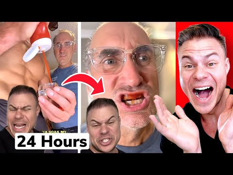 Will 24 Hours Of Ketchup Stain Your Teeth?! Orthodontist Reacts