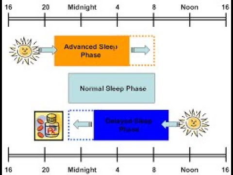 Advanced Sleep Wake Phase Disorder (circadian ...