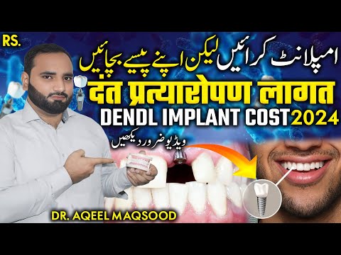 how much Dental implant cost 2024 | Dental implant Price in Pakistan  | dant lagane ka kharcha