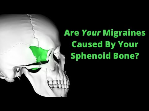Are Your Migraines Caused By Your Sphenoid Bone? | Simply Chiropractic | Holly Springs, NC
