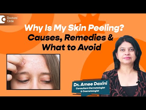 Skin Peeling on Face, Hands or Feet? | Real Reasons & Remedies - Dr. Amee Daxini | Doctors' Circle