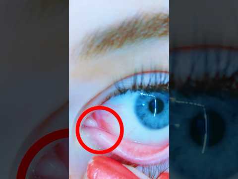 Am I the only one who has this? #norrisnuts