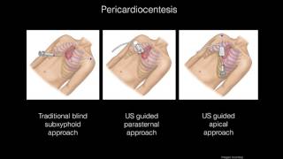 Dual Diagnosis by Bedside Ultrasound