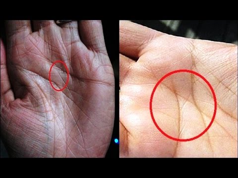 Wastong nutrisyon para sa pagbawi ng tiyan para sa mga kalalakihan Luya tea sa bahay para sa pagbaba ng timbang
