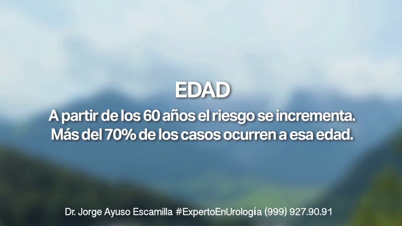 Jorge Ayuso Escamilla-36