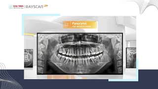 RAYSCAN ALPHA PLUS – Giải pháp hình ảnh 5D toàn diện. #niengrang #dentist