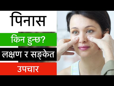 Pinas/Sinusitis in Nepali/Pinas ko laxan/Pinas ko aushadhi, pinas ko gharelu upachar