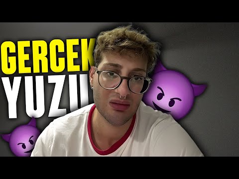 CAN'S HARSH REPLY TO JACK RUSSO