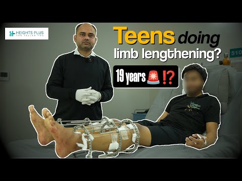 Unfiltered Truth: Pain, Recovery, and Hope After Height increase Surgery