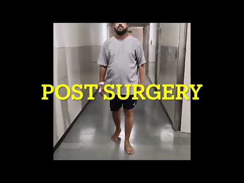 Micro endoscopic Spine surgery boon for patient of Slip disc