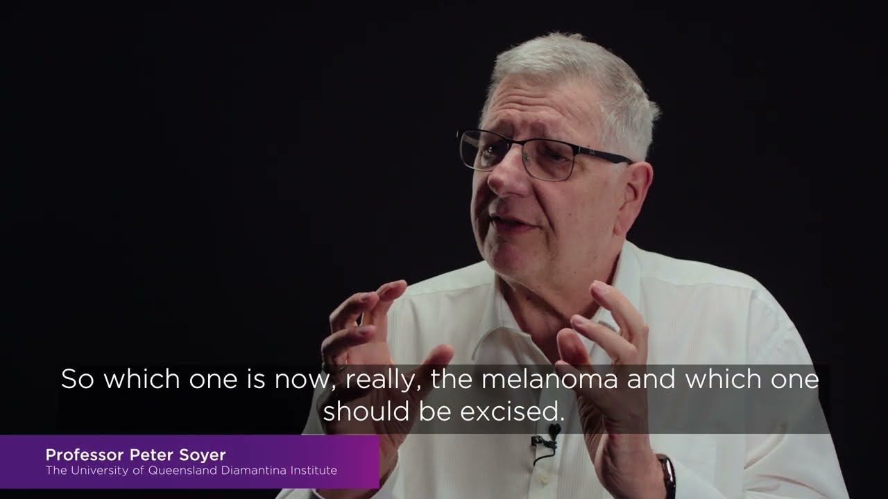 AI impact in medical imaging