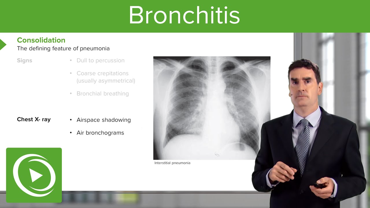 Bronchitis: Consequences, Symptoms & Treatment – Respiratory Medicine | Lecturio - YouTube