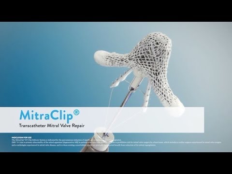 MitraClip® Transcatheter Mitral Valve Repair