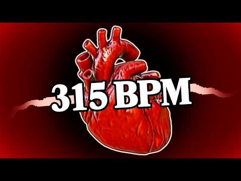 I Gambled So Hard I Literally Died