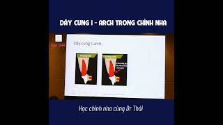 Dây cung I - Arch trong chỉnh nha. #nhakhoa #dainha #niengrang #dentist