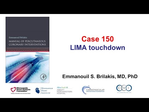 Case 150: PCI Manual - LIMA touchdown