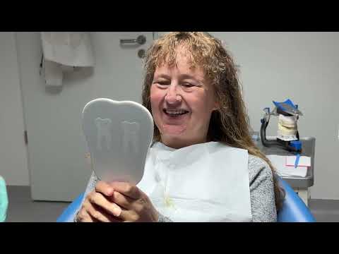 Totalprothese (Teleskopprothese - Zahnersatz mit Teleskopkronen) Teil II: die Prothetik & Finish