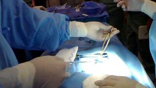 APPENDECTOMY part 1 instrument setup class