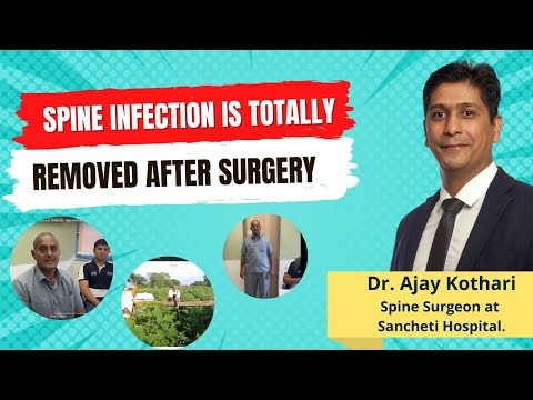 Spine Infection is Totally removed after Surgery | Success story | Dr. Ajay Kothari