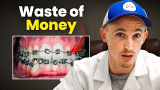 3 "Better" Orthodontic Treatments That Are Money-Wasters | Dentist Explains